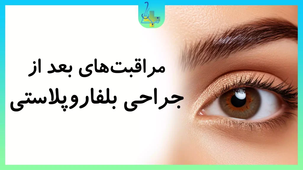 مراقبتهای پس از جراحی بلفاروپلاستی