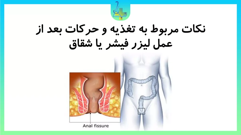 نکاتی مربوط به تغذیه و حرکات بعد از عمل های لیزر انجام شده در کلینیک نیکان