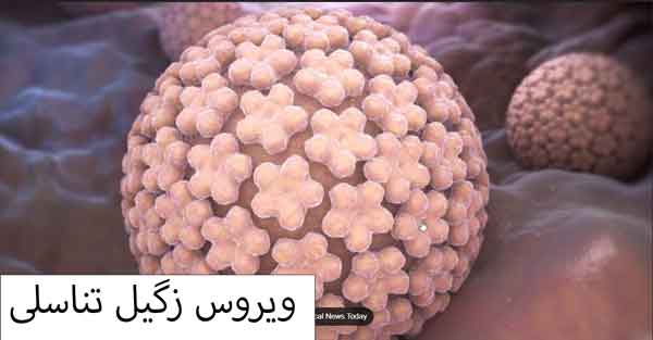 عکس ویروس زگیل تناسلی