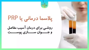 پلاسما درمانی PRP