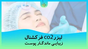 17 نکته که باید در مورد لیزر CO2 فرکشنال بدانید!