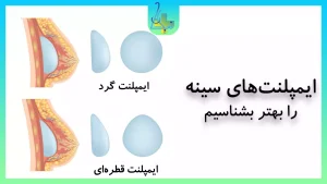 ایمپلنتهای سینه
