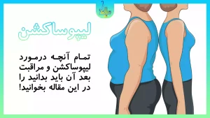 بهترین روش انجام لیپوساکشن لیرز