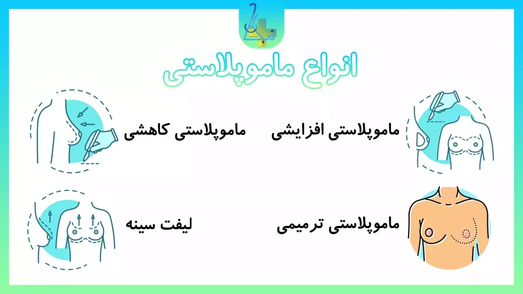 انواع روشهای ماموپلاستی