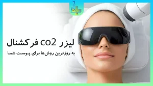 لیزر co2 فانکشنال