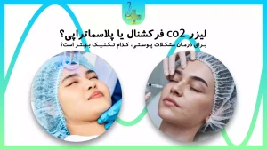 مقایسه لیزر co2 فرکشنال با پلاسماتراپی، کدام یک بهتره؟