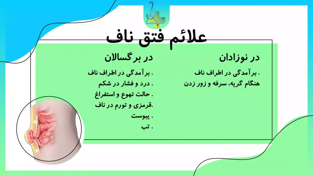 علائم فتق ناف و مراجعه به پزشک