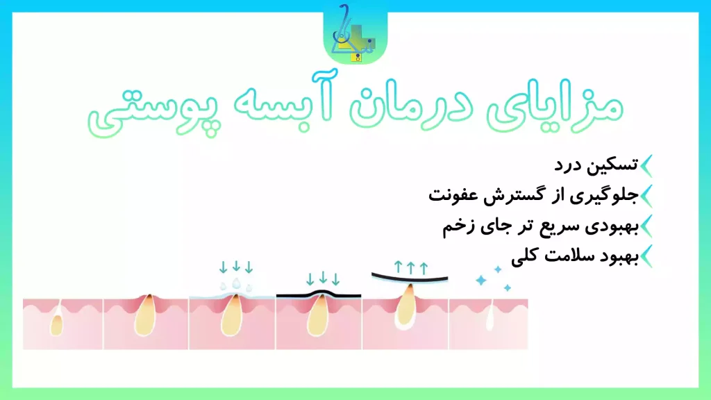 مزایای درمان آبسه پوستی