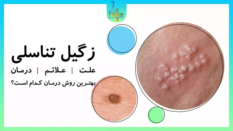 زگیل تناسلی علل، علاثم و نشانه ها