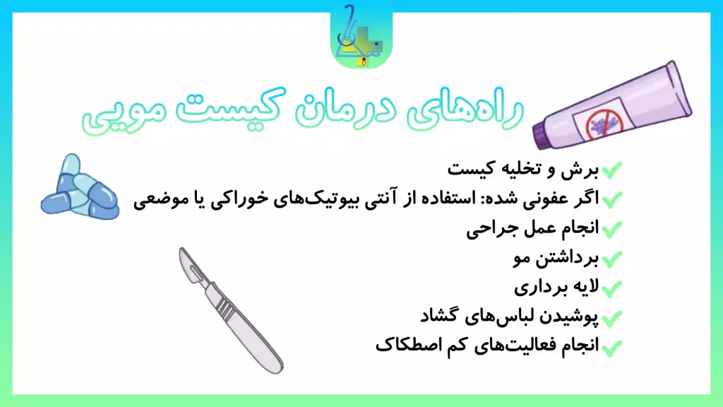 راه‌های درمان کیست مویی چیست؟