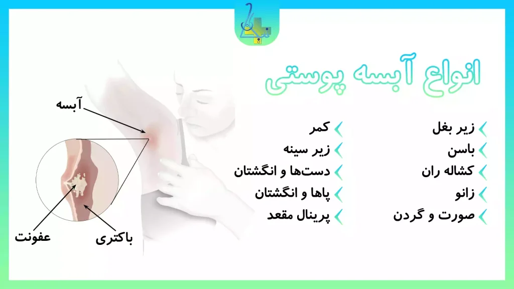 انواع آبسه پوستی
