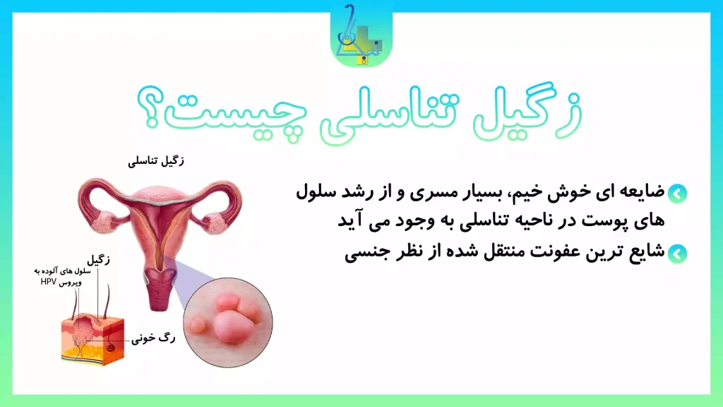 زگیل تناسلی چیست؟