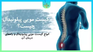 کیست مویی چیست؟ انواع آن و راههای درمان