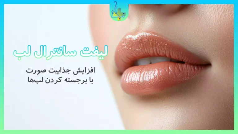 آشنایی با مزایا و معایب لیفت سانترال لب