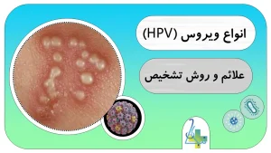 بررسی علائم و روش تشخبص ویروس (HPV)