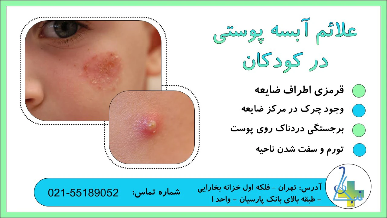 علائم آبسه پوستی در کودکان