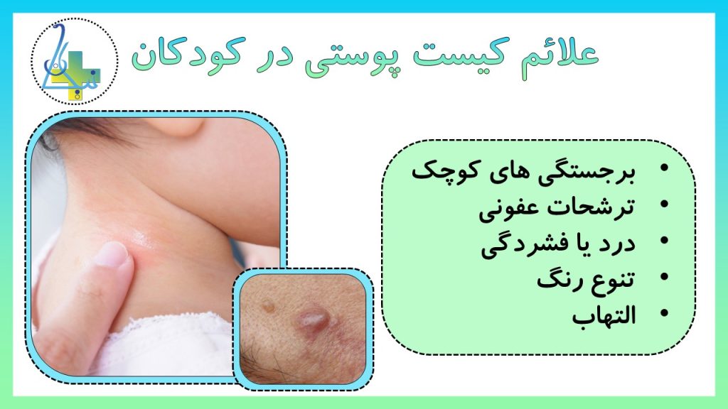 علائم و نشانه‌های کیست پوستی در کودکان