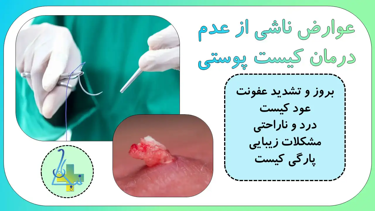 عوارض ناشی از عدم درمان کیست پوستی