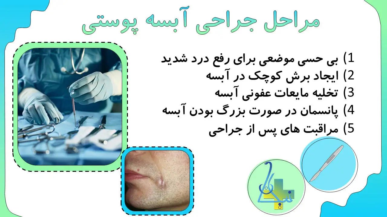 مراحل جراحی آبسه پوستی چیست؟
