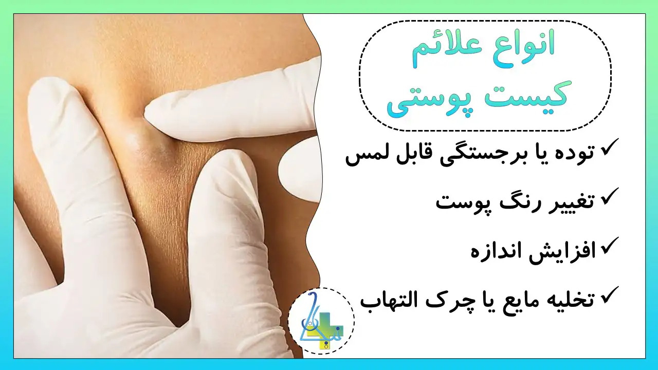انواع علائم کیست پوستی در زنان و مردان چیست؟