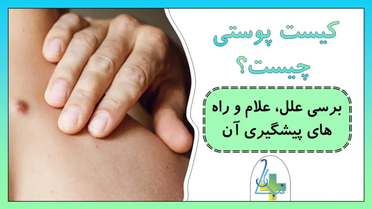 کیست پوستی چیست؟ بررسی علل و علائم کیست پوستی